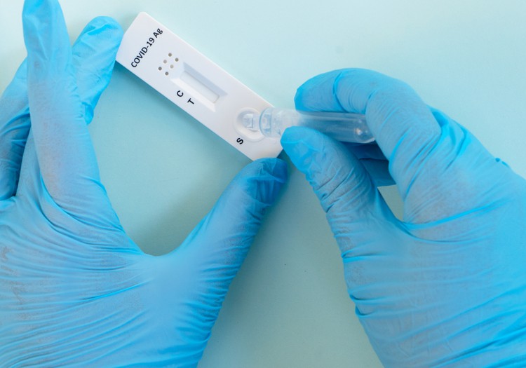 Padomi situācijai – Covid-19 tests ir veikts. Ko darīt tālāk?