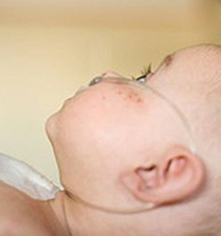 Miris nevakcinētais zīdainis