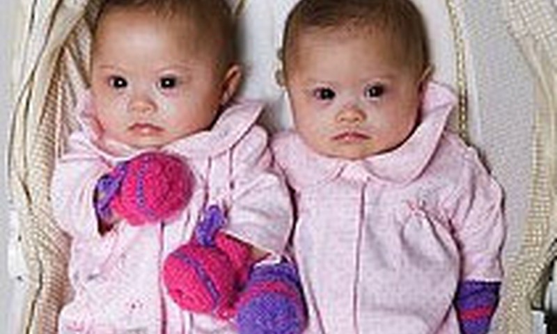 Bērnu slimnīcā priekšlaikus dzimušie dvīnīši varēs gulēt kopā!