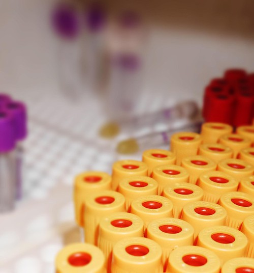 12. novembrī akcijā "Atklāj. Rīkojies!" visās "Centrālās laboratorijas" filiālēs bez maksas varēs nodot C hepatīta analīzes