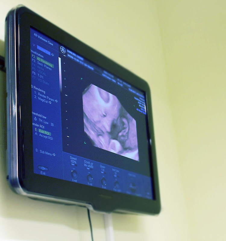 Kāds ir spontāna aborta risks?