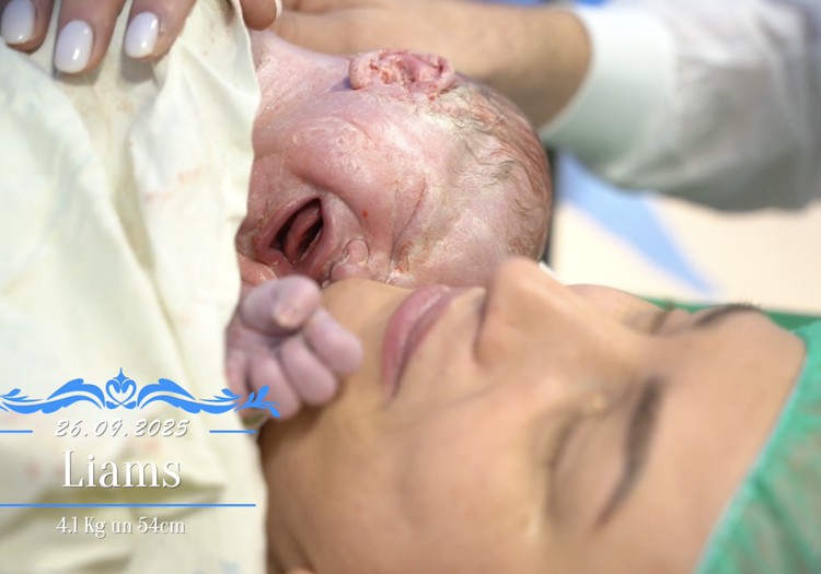 VIDEO: Superbēbīša 2025 ķeizargrieziena dzemdības