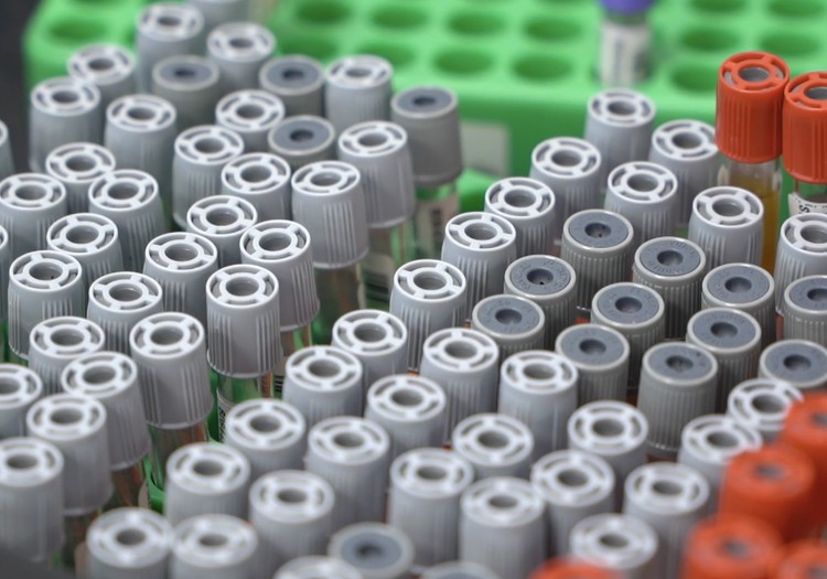 Cik bieži bērnam jānodod analīzes?