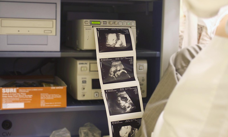 Neinvazīvu ģenētisks izmeklējums (NIPT) „Panorama” grūtniecēm