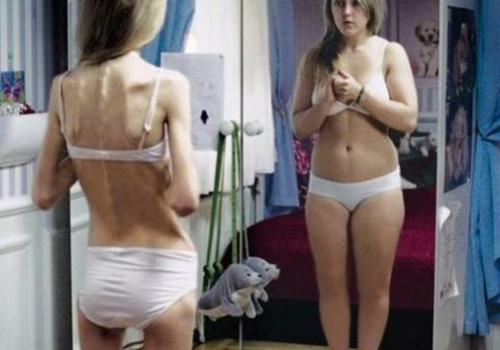 Anoreksija. Lēnā miršana?