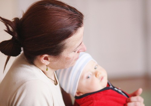 Ar masalām un masaliņām pērn Latvijā slimojuši vien 11 cilvēki