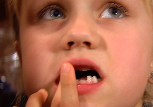 VIDEO: kurš aiznes pirmo zobiņu? Jūs ticat zobu fejām?