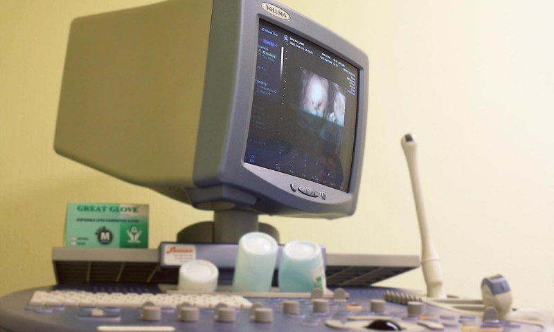 Trīsdimensiju ultrasonogrāfija – mīti un patiesība