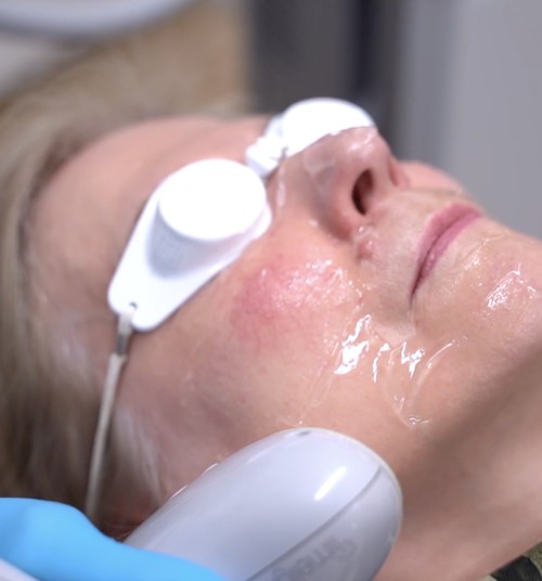 Kā uzlabot apsārtušu sejas ādu?