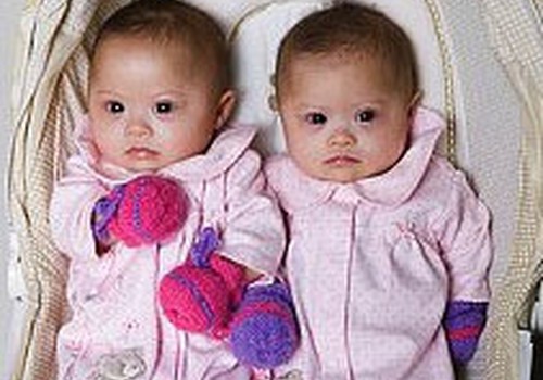 Bērnu slimnīcā priekšlaikus dzimušie dvīnīši varēs gulēt kopā!