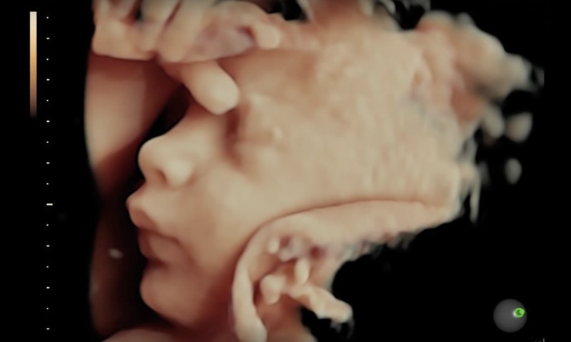 Iegūsti sava mazuļa pirmo fotogrāfiju ar 3/4 D ultrasonogrāfijas palīdzību