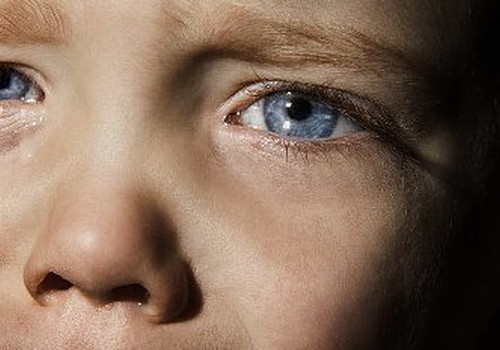 Atklājam, kādas ir izplatītākās acu problēmas bērniem