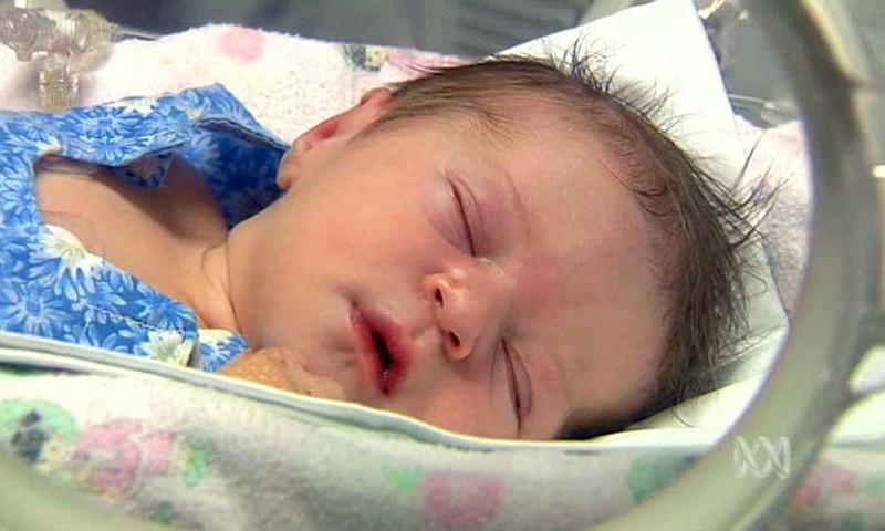 Mediķi vakar hospitalizējuši divus saulē pārkarsušus zīdainīšus
