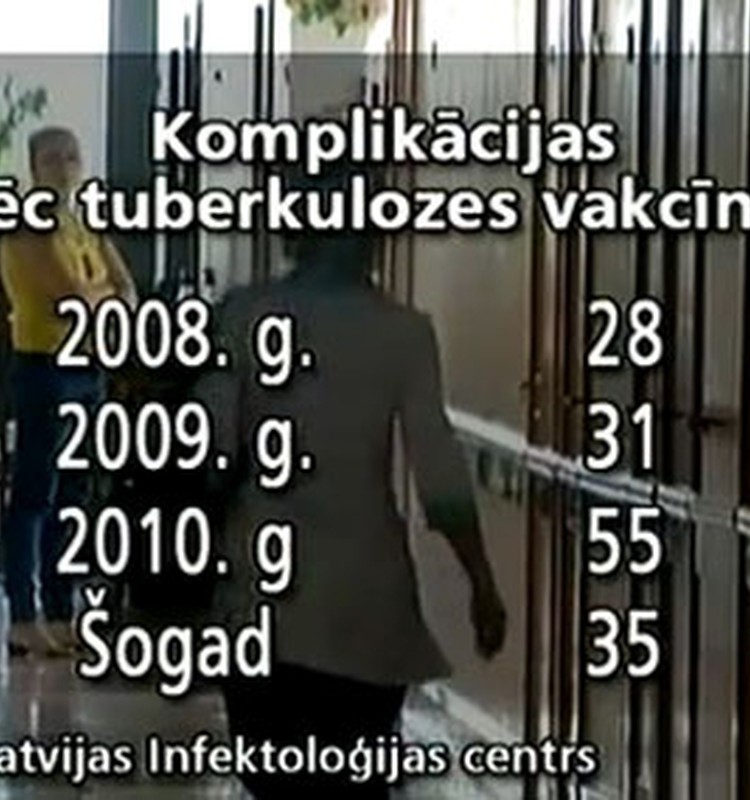 Zīdaiņiem smagas komplikācijas pēc tuberkulozes vakcīnas