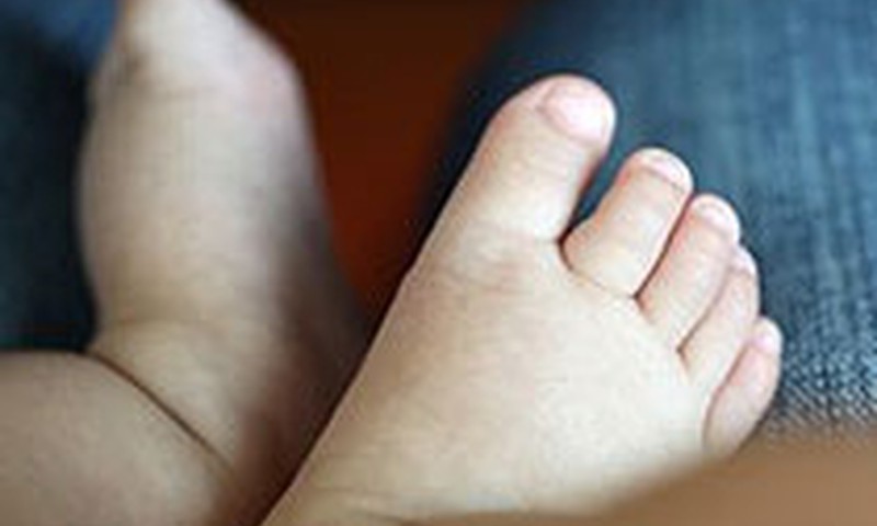 Bērnam ieaudzis nags