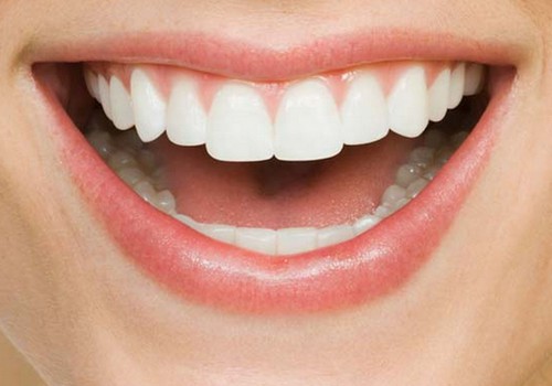 7 produkti, no kuriem izvairīties, ja sapņo par žilbinoši baltu smaidu