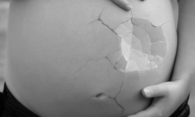 Ārpusdzemdes grūtniecība jeb kāpēc mans bērniņš nepiedzima