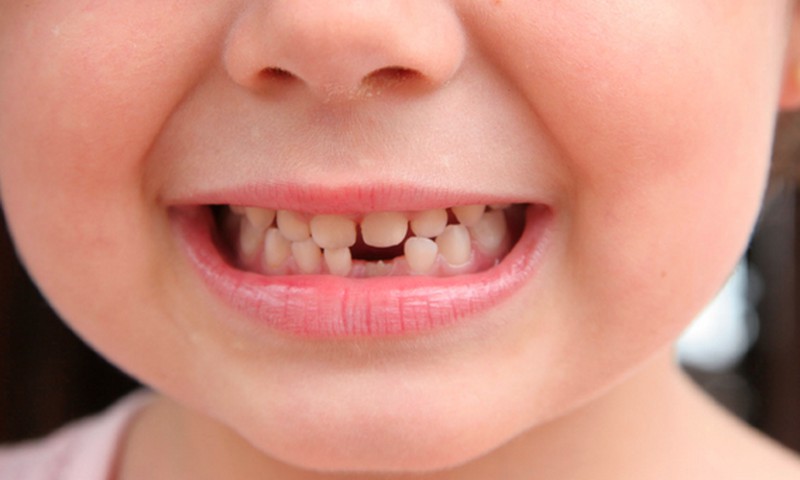 8 triki, kas motivēs bērnu tīrīt zobus!