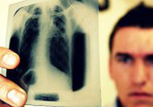 Bērnu vidū izplatās tuberkuloze: Latvija - viena no ES līderēm