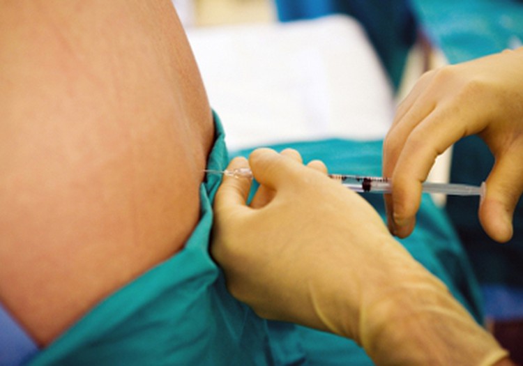 Kāpēc neiedarbojas epidurālā anestēzija? Lasi atbildi un piesakies uz Dzemdību sagatavošanas kursiem!