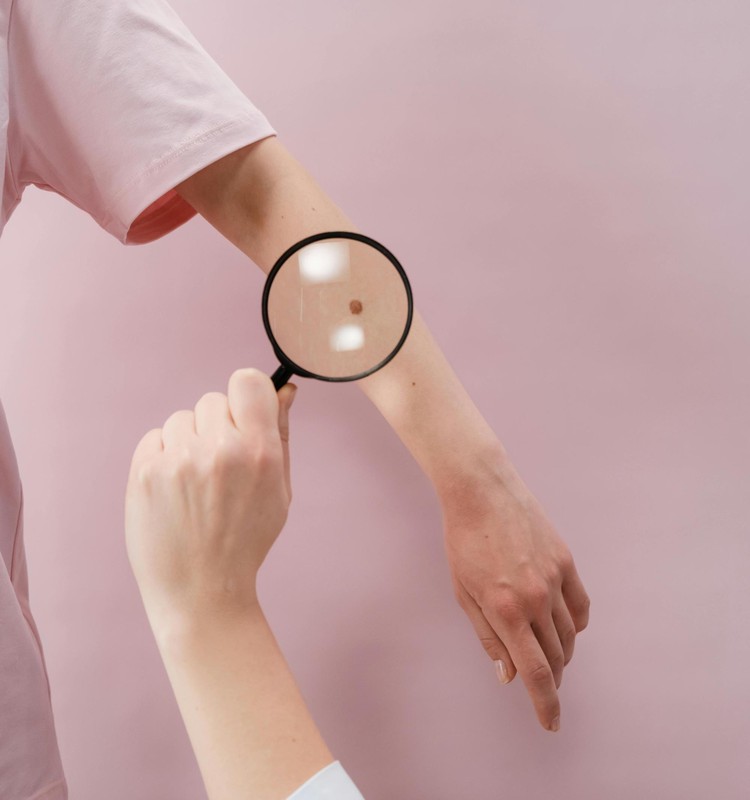 Ādas vēzis: pazīmes, profilakse un ārstēšana – dermatologa padomi