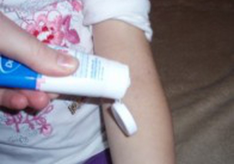 Meitai atopiskā dermatīta uzliesmojums- izmēģinām Dermalex Repair!