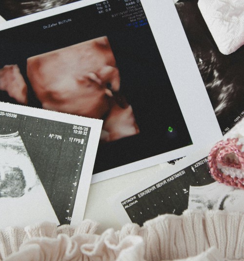 Topošo māmiņu vitamīni