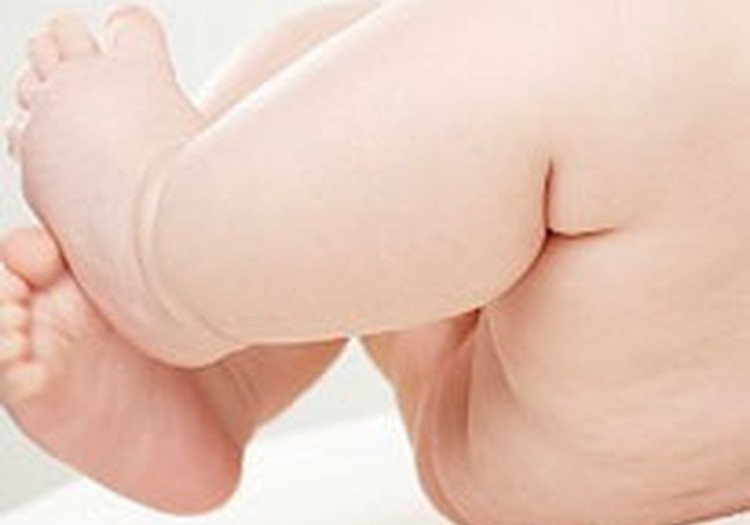 Aizsardzība pret autiņbiksīšu dermatītu