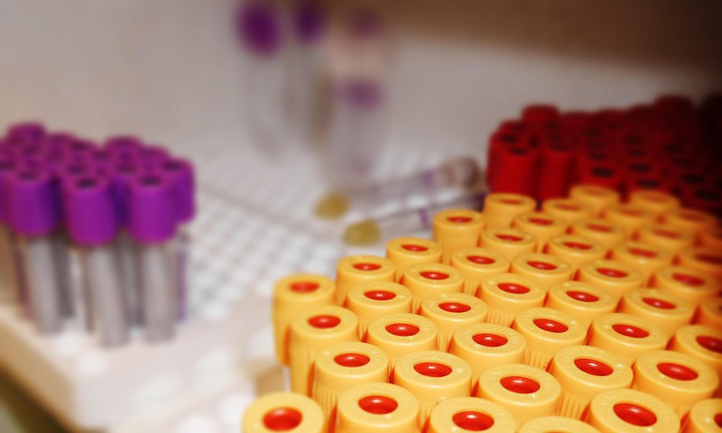 12. novembrī akcijā "Atklāj. Rīkojies!" visās "Centrālās laboratorijas" filiālēs bez maksas varēs nodot C hepatīta analīzes