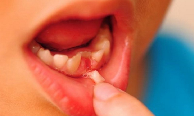 INTERESANTI: Iemesls, kāpēc bērna piena zobiņus nevajadzētu atdot zobu fejai. Apbrīnojams atklājums!