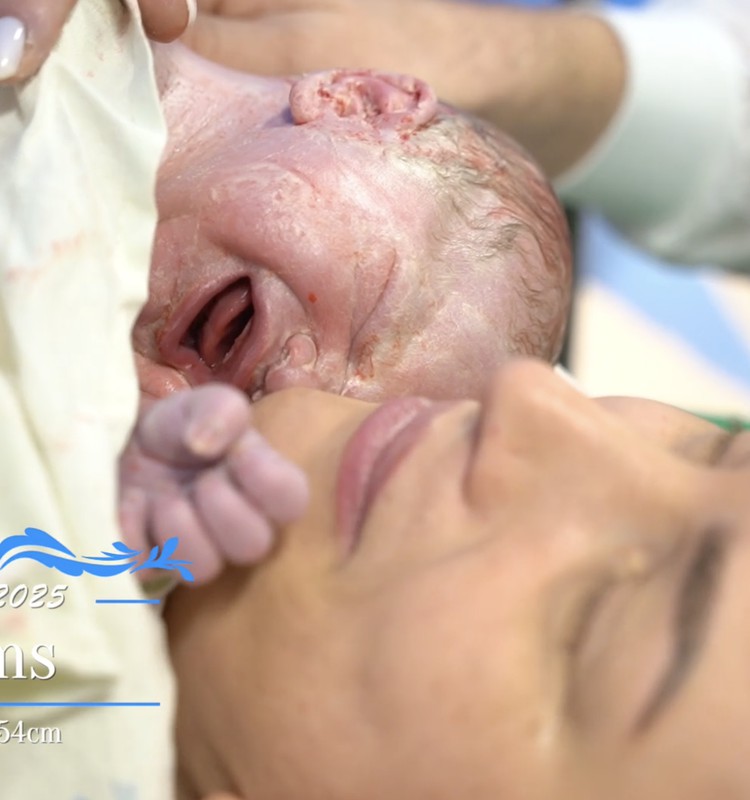 VIDEO: Superbēbīša 2025 ķeizargrieziena dzemdības