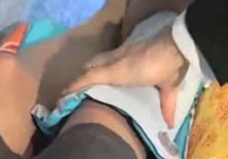 Atvēsinošas kompreses topošo māmiņu labsajūtai