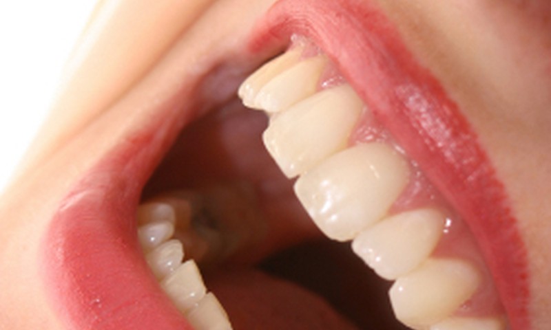 Baltāki zobi ar zemenēm