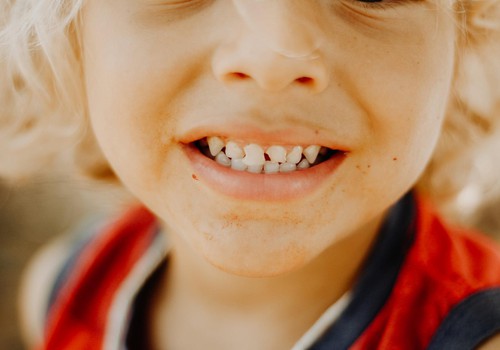 Uzdod savus jautājumus par bērna zobiņiem ortodontam!