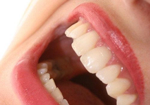 Baltāki zobi ar zemenēm
