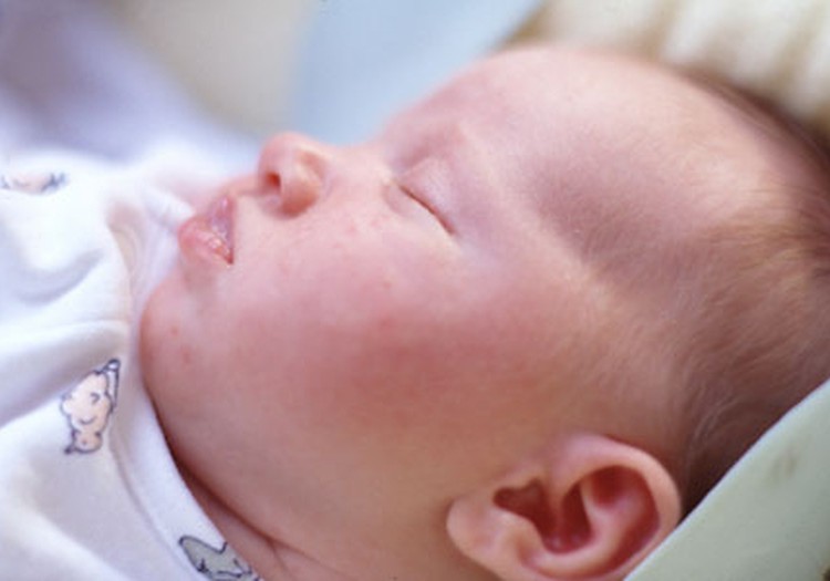 Uzdod savu jautājumu homeopātam Edgaram Mednim par alerģijām!