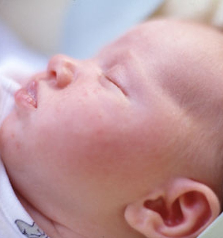 Uzdod savu jautājumu homeopātam Edgaram Mednim par alerģijām!