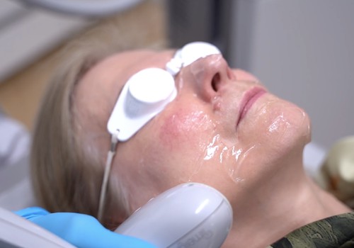 Kā uzlabot apsārtušu sejas ādu?