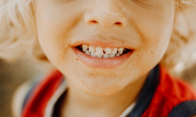 Uzdod savus jautājumus par bērna zobiņiem ortodontam!