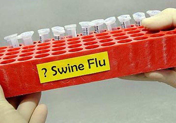 Vācietis nomirst neilgi pēc vakcinēšanās pret cūku gripu