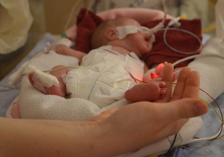 17.novembrī tiks atzīmēta Pasaules Priekšlaicīgi dzimušo bērnu diena