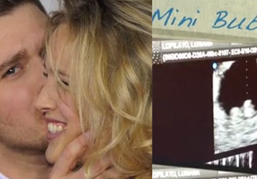Video: Bublē sieva atklāj bēbīša pirmo sonogrammu