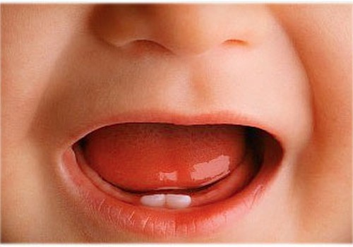 Aptauja: Dentokind tabletes palīdz mazo zobiņu nākšanas laikā!
