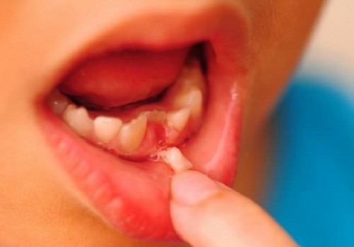 INTERESANTI: Iemesls, kāpēc bērna piena zobiņus nevajadzētu atdot zobu fejai. Apbrīnojams atklājums!