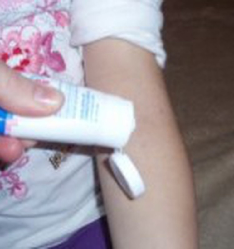 Meitai atopiskā dermatīta uzliesmojums- izmēģinām Dermalex Repair!