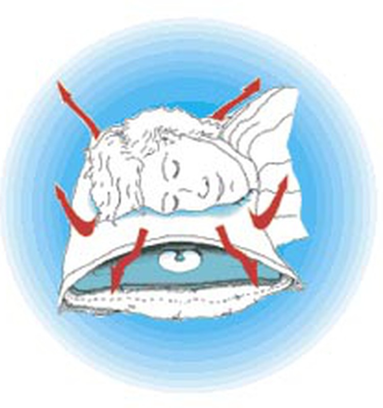 Unikālais putu maisījums Chillow® spilvenā