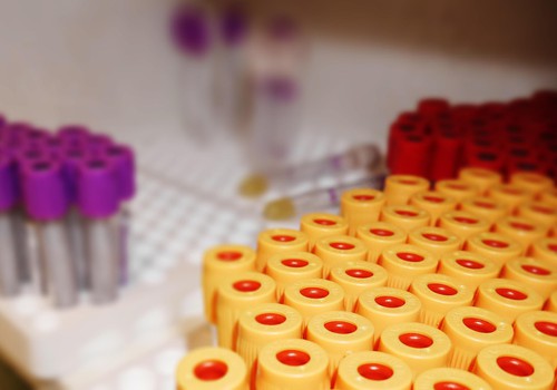 12. novembrī akcijā "Atklāj. Rīkojies!" visās "Centrālās laboratorijas" filiālēs bez maksas varēs nodot C hepatīta analīzes