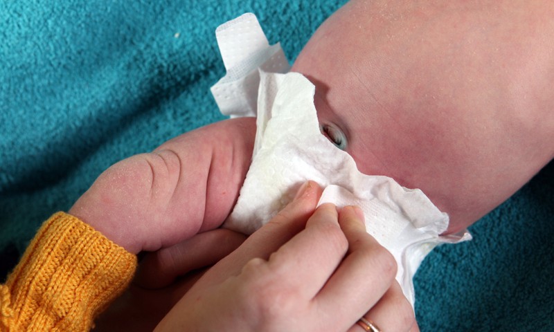 Rūpes par nabiņu: 5 ieteikumi, kas jāņem vērā